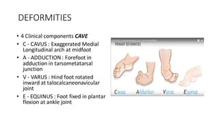 scratch test ctev|Introduction to Clubfoot .